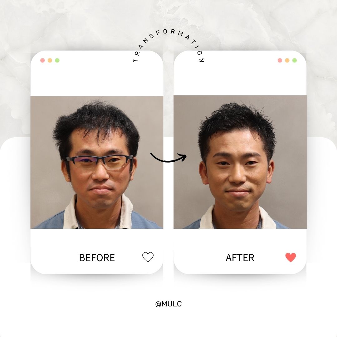 【Before/After】File.09「新しい自分に生まれ変わりたい」